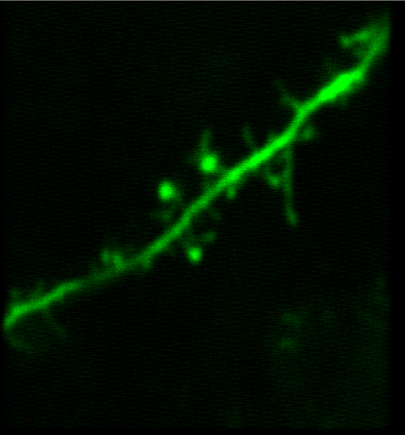 Imaging Visually Evoked Synaptic Calcium Transient In Vivo