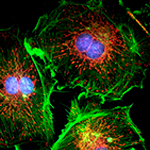 Fluorescence Microscopy