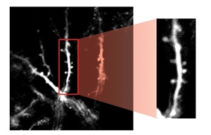 High-Resolution Imaging