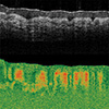 Tissue Birefringence