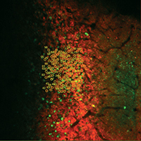 Photostimulation with Spatial Light Modulator