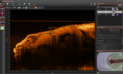 OCT Software 2D Mode