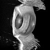 3D rendering of OCT scans eye