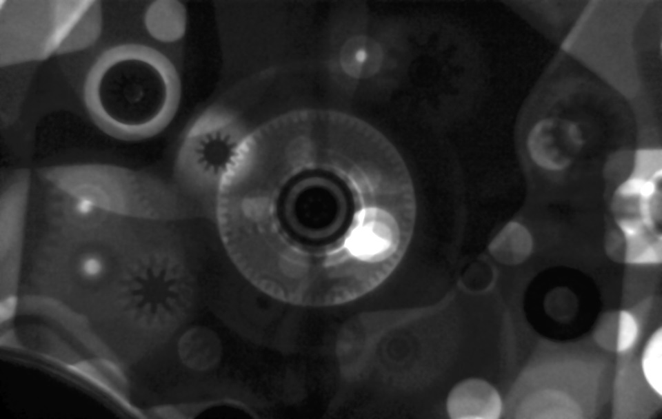 X-ray image of a wrist watch. Blurry areas are due to moving components rather than insufficient imaging resolution.