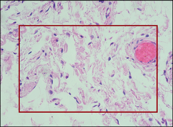 Sample Image of Human Ileum