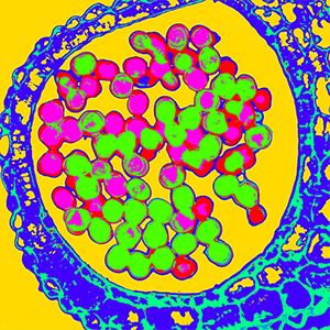 Flower Bud Component Analysis